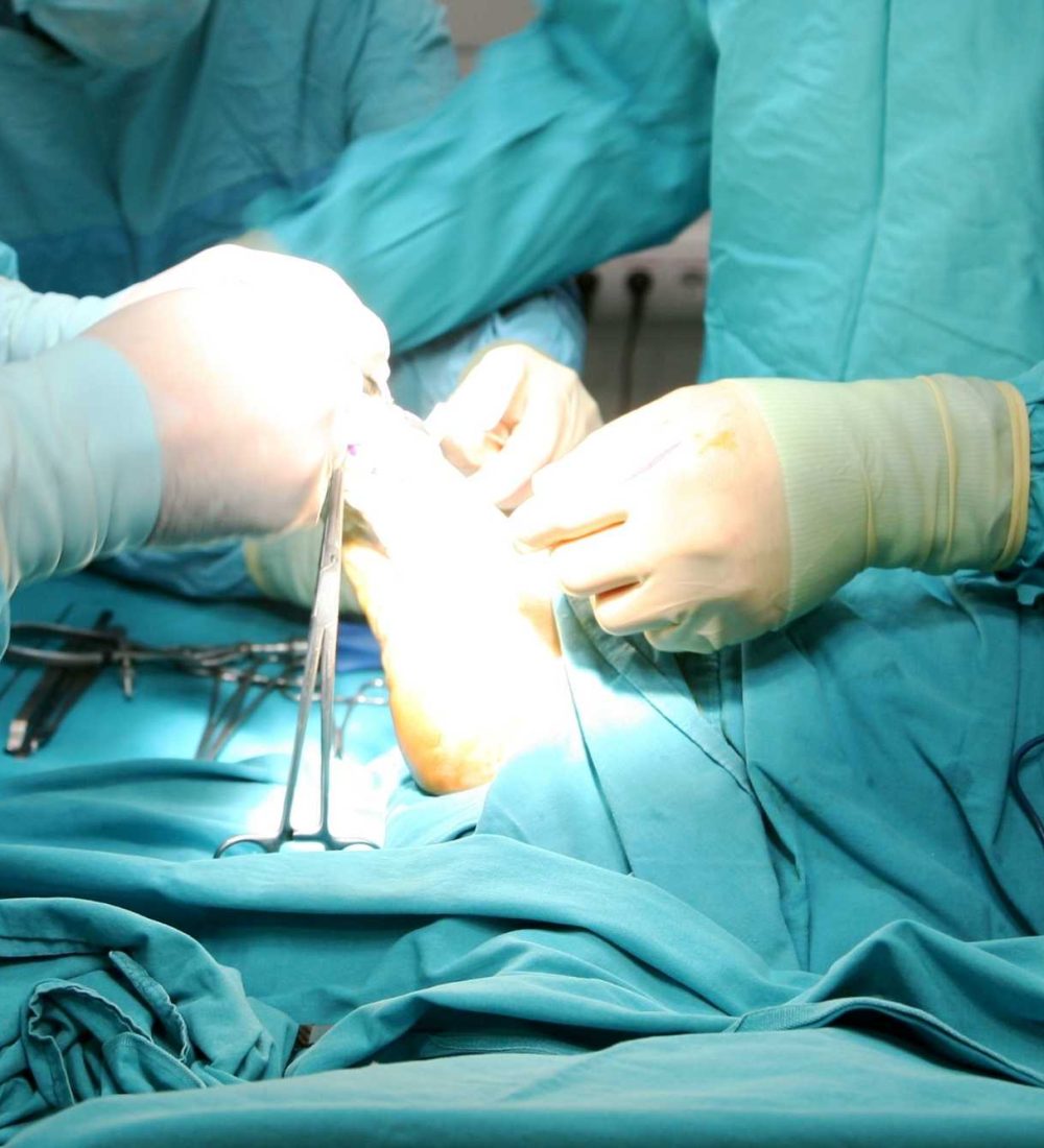 Cirugía Ungueal y Cirugía MIS en Alicante