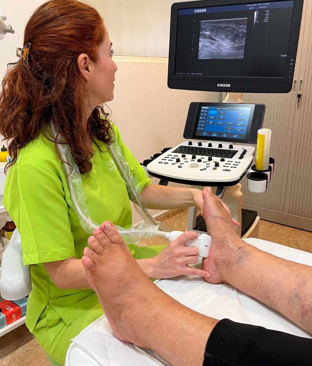 Podólogo-en-Alicante-Podopie